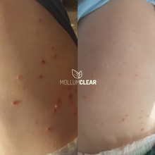 Load image into Gallery viewer, Regular Strength Mollumclear Bundle